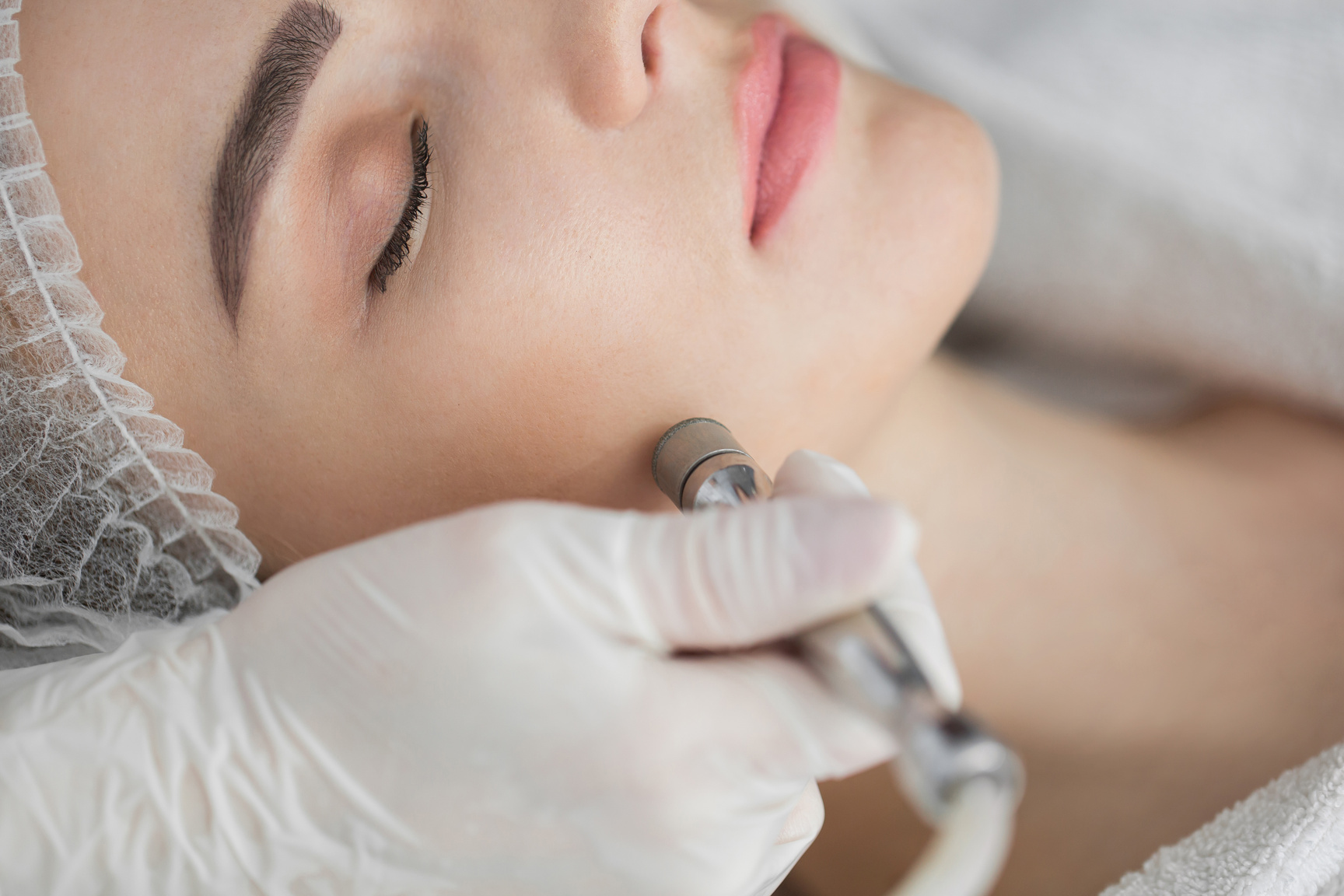 Diamond Microdermabrasion, Peeling Cosmetic. Woman during a Microdermabrasion Treatment